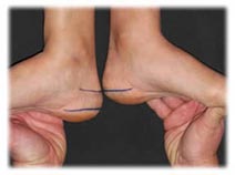beinlaenge